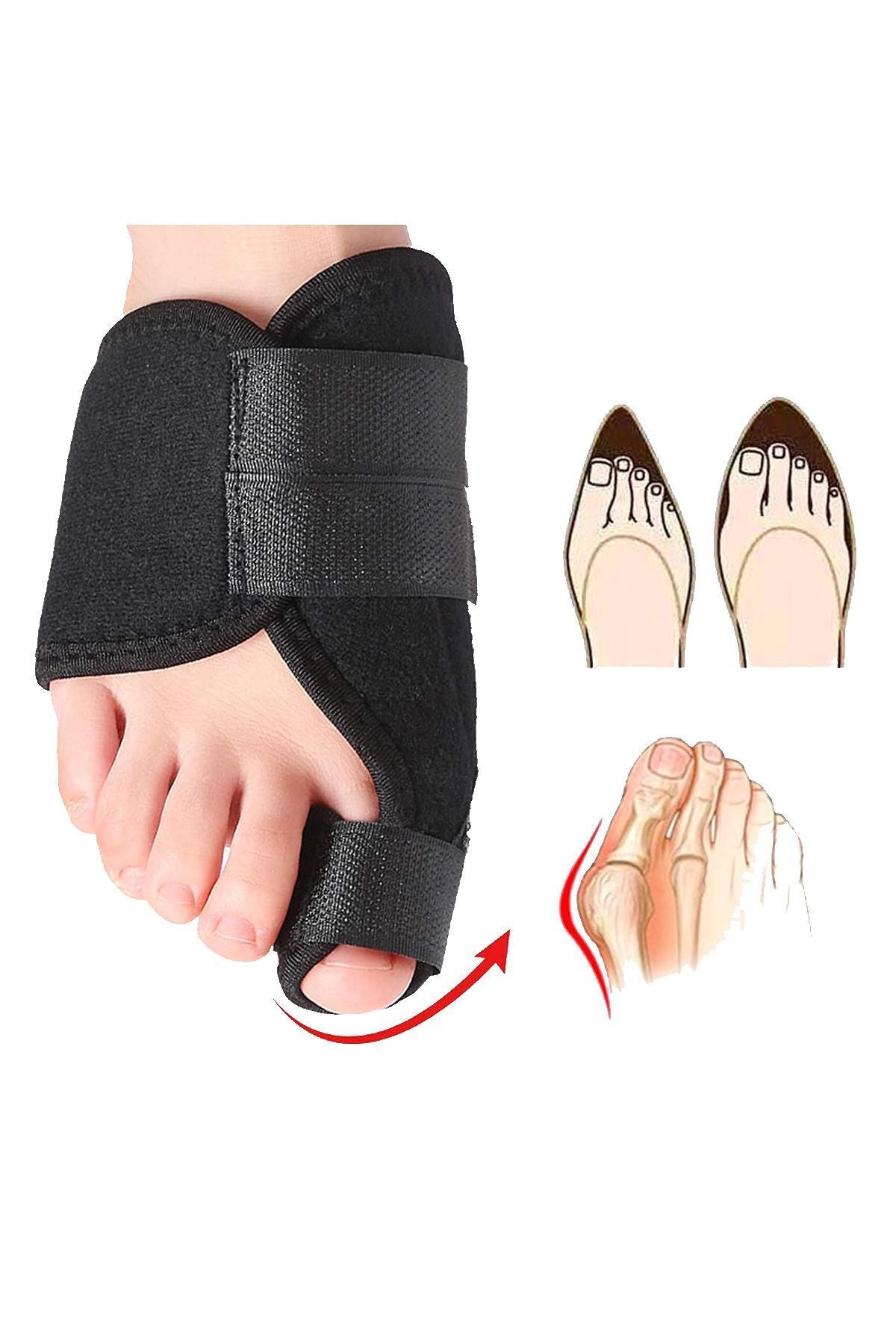 Halluks Valgus Gece Ateli Sağ Ve Sol Ikili | Ayak Başparmak Düzeltici Bunyon Kemik Çıkıntısı Aparat