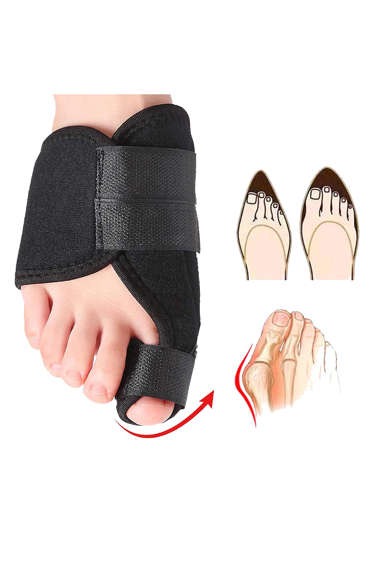 Ayak Başparmak Gece Ateli 2’li Set | Halluks Valgus Kemik Çıkıntısı Düzeltici Ortopedik Aparat